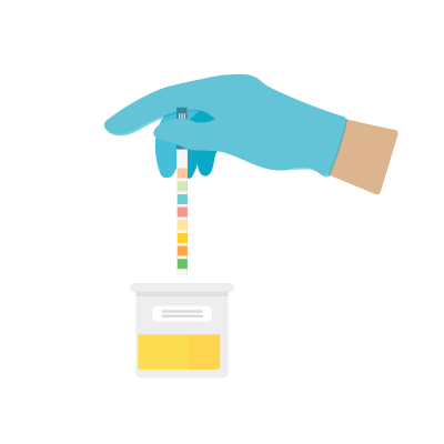 urine test