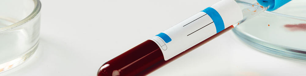 blood test