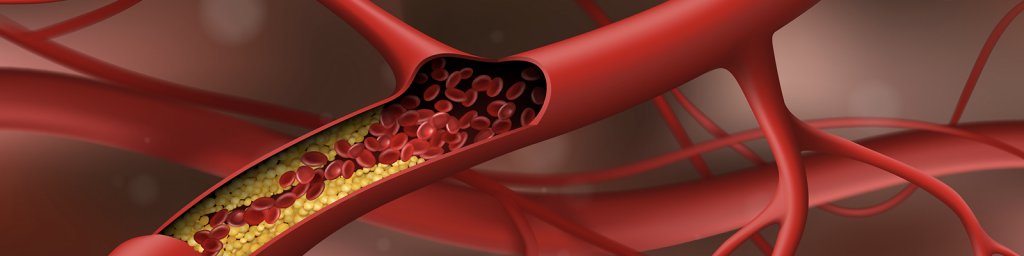 supplements-high-cholesterol