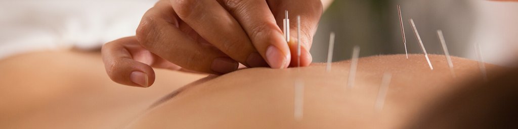 acupuncture benefits