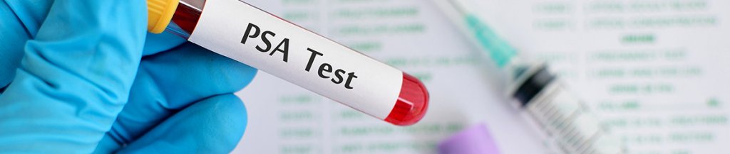 psa levels in bph