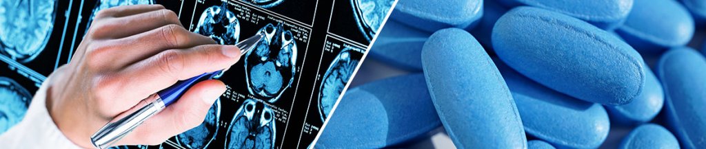 alzheimer disease viagra